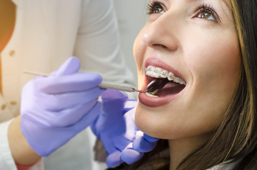 Closeup Of Beautiful Girl With Dental Braces Check Up