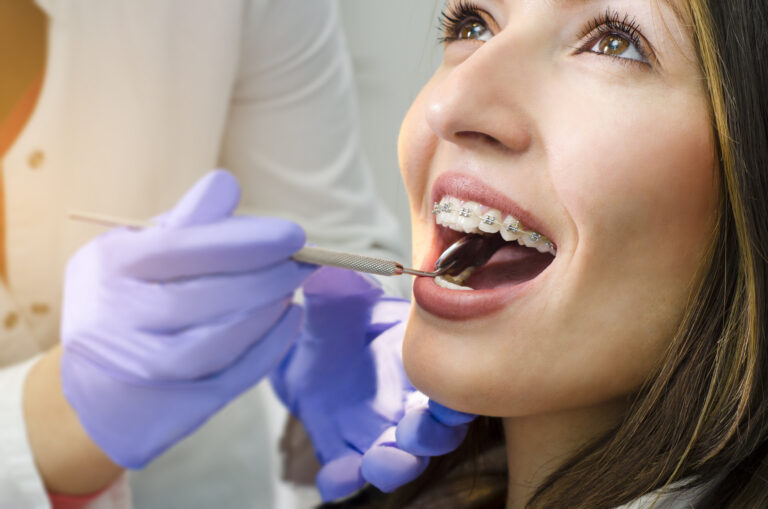 Closeup Of Beautiful Girl With Dental Braces Check Up
