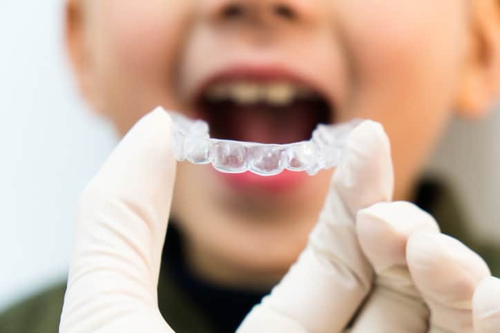 Orthodontist with latex gloves inserting a clear aligner into the mouth of a child